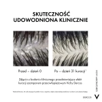 VICHY DERCOS Szampon Przeciwłupieżowy Z Odżywką 2w1 - 200ml