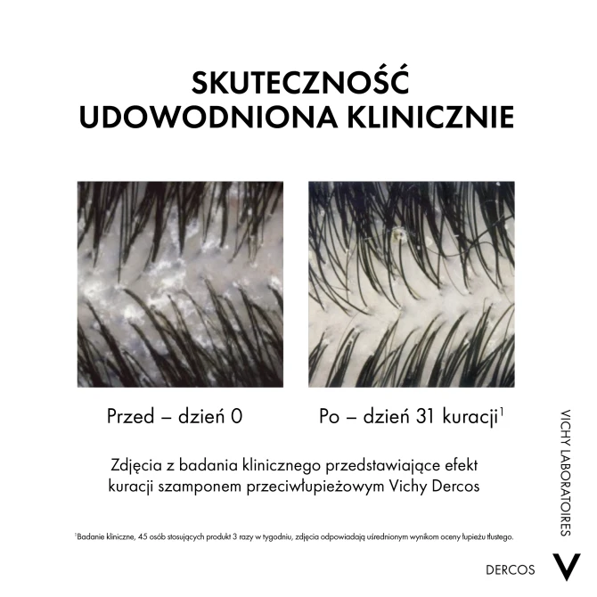 VICHY DERCOS Szampon Przeciwłupieżowy Z Odżywką 2w1 - 200ml