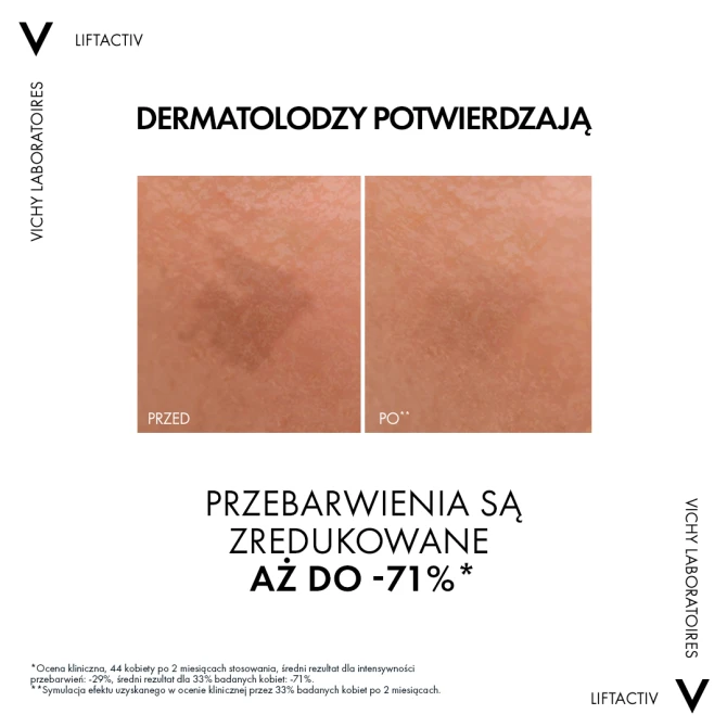 VICHY LIFTACTIV Specialist B3 Serum Redukujące Przebarwienia I Zmarszczki z 5% Niacynamidu - 30ml