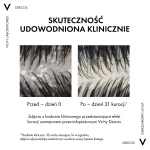 VICHY DERCOS Szampon Przeciwłupieżowy Włosy Przetłuszczające Się - 200ml