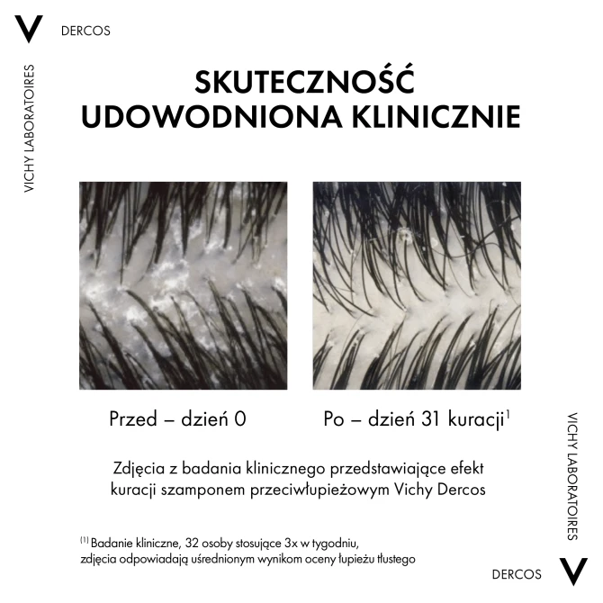 VICHY DERCOS Szampon Przeciwłupieżowy Włosy Przetłuszczające Się - 200ml