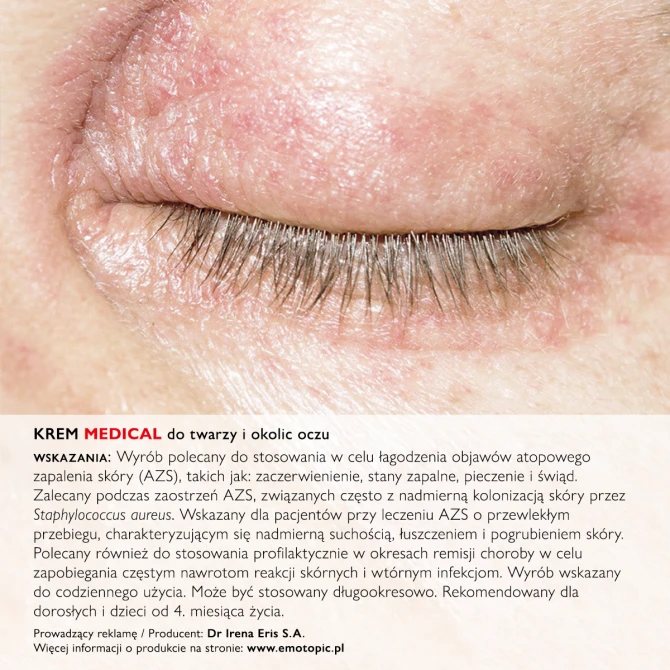 Emotopic Bacteria Control Krem Medical Do Twarzy i Okolic Oczu - 50ml