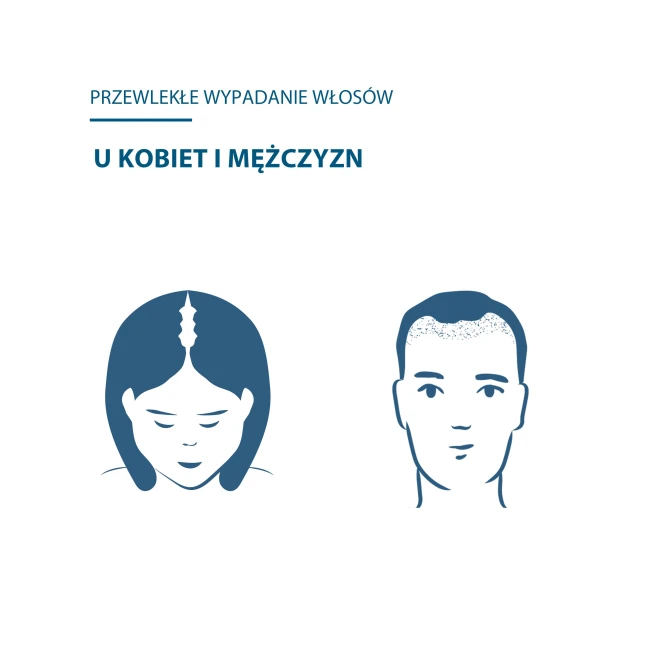 DUCRAY ANACAPS EXPERT Suplement diety na wypadanie włosów - 30 kapsułek (id: 72481)