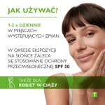 PHARMACERIS T AZELOACNE Krem z 20% kwasem azelainowym do dermopielęgnacji skóry trądzikowej i z przebarwieniami